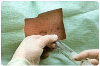epidural-anestezi.jpg