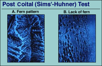 Sims Huhner testi