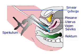 Smear testi, rahim ağzından sürüntü alınması, kanser tarama testi