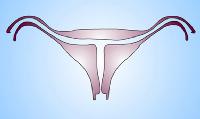 t-uterus.jpg