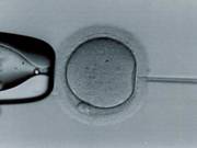 Mikroenjeksiyon, tüp bebek