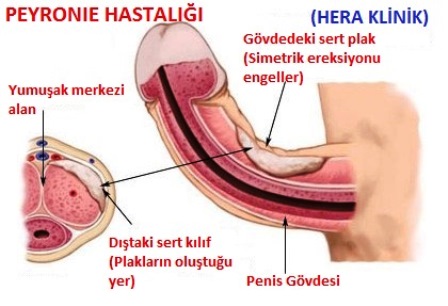 adaзayinin erkeklere zararlari