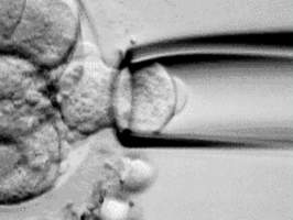 PGD, preimplantasyon genetik tan, biyopsi