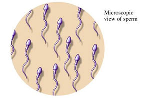 Sperm sayımı, terminoloji, azospermi, oligospermi