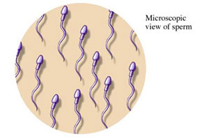 Sperm saym, terminoloji, azospermi, oligospermi