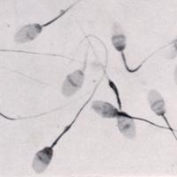 Sperm rnei verme, spermiogram, sperm analizi, sperm testi