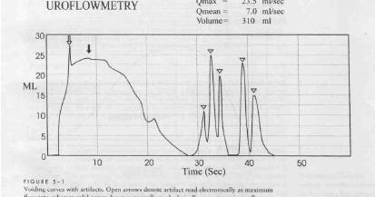 roflowmetri, rodinamik test, oroloji, rolojik laboratuar testler