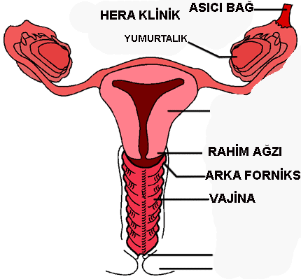 Vajina estetii, vajen, vajinal kanal, kzlk zar, vajina daraltma
