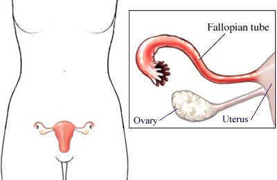 Kadn yumurtalklar, overler, fallop tpleri